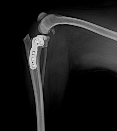 슬개골/십자인대 수술